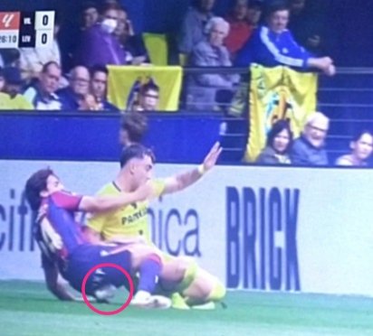 Analysis_Injury's tweet photo. 🚨 Lesión de Carlos Álvarez.

El jugador del @LevanteUD no puede continuar tras esta acción.

Torsión en el tobillo izquierdo compatible con un esguince en la sindemosis.

De confirmarse este diagnóstico, tendría muy difícil jugar lo que queda de temporada. https://t.co/j6TJazvepB