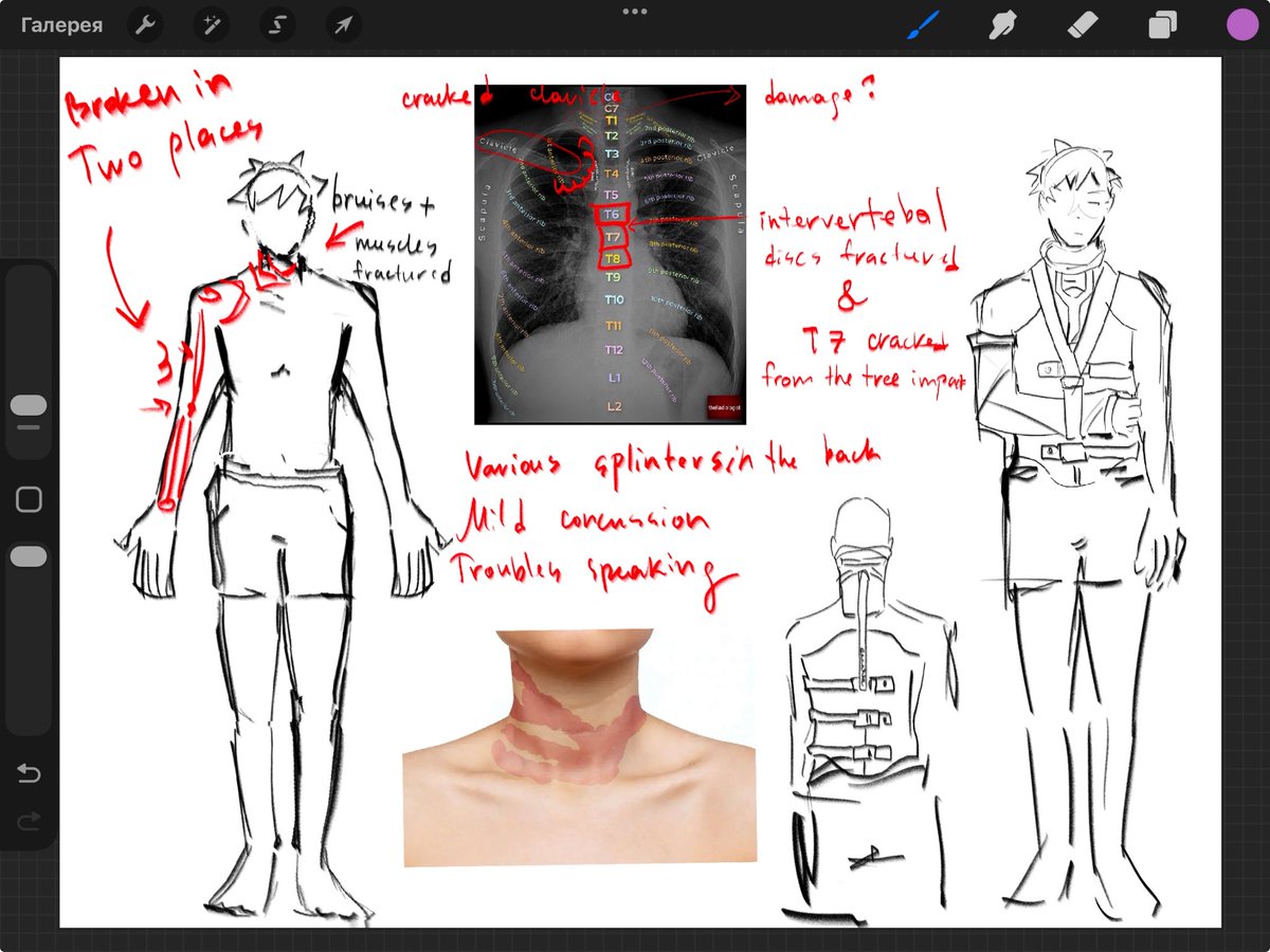 feicgy's tweet photo. Teruki post confession arc ifgaf he was in a hospital for MONTHS after allat. https://t.co/ql9tUlc8GS