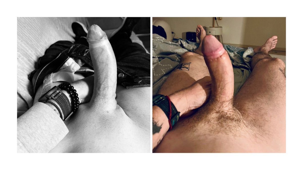 Left before 17cm. Right after circumcision 16cm … but a bit wider and thicker
#beforeafter #circumcision #cutdick