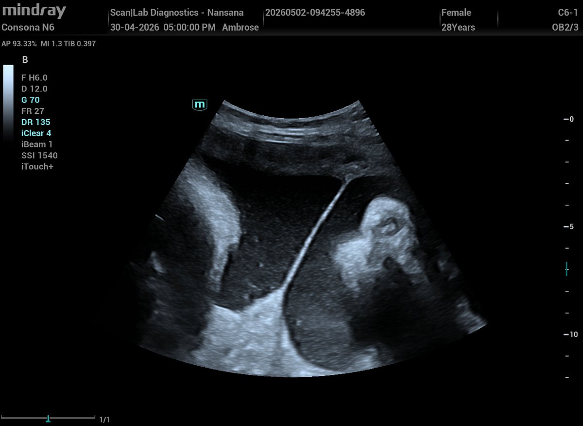 Ambrose - The Sonographer (Sonar Master). tweet media