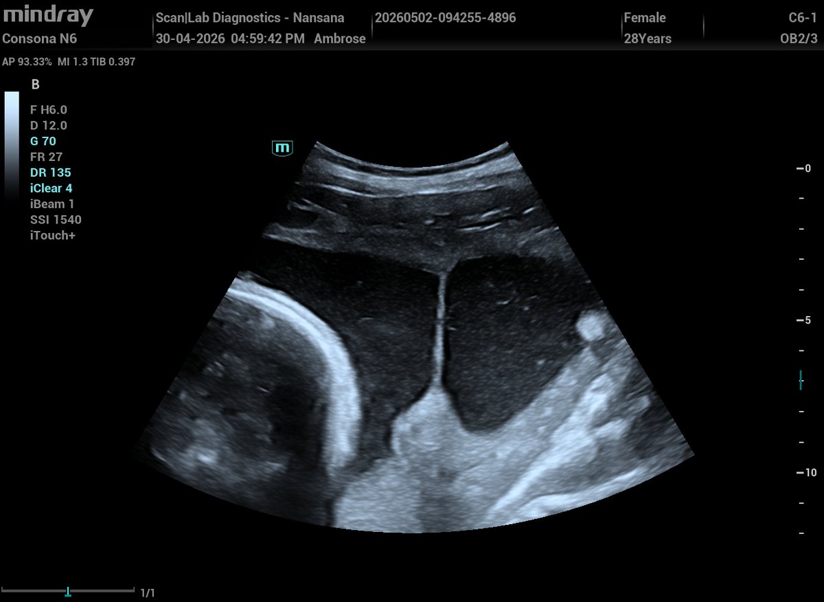 Ambrose - The Sonographer (Sonar Master). tweet media
