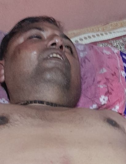 UtpalDasBJP's tweet photo. তুফানগঞ্জের বিজেপি কর্মী সুখোময় দেকে আ*গ্নে*য়া*স্ত্র দেখিয়ে ২ঘন্টা ধরে লোহার রড দিয়ে বেধড়ক ভাবে মারধর করেছে তা সত্যি লজ্জা জনক।
এই ঘটনায় জড়িত যারা আছে তাদের আইনগত ভাবে কঠিন শাস্তির দাবি জানাচ্ছি।
@ECISVEEP @WBPolice
#Tufanganj #Coochbehar https://t.co/v8qjPIQipe