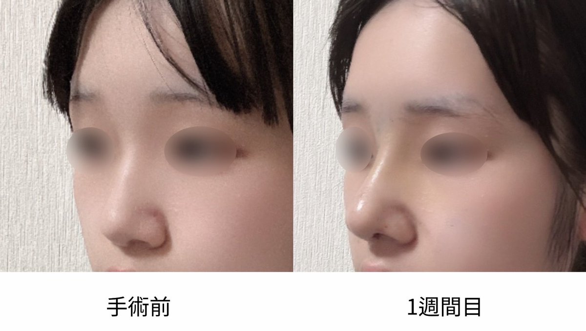 ୨୧.@鼻フルDT tweet media