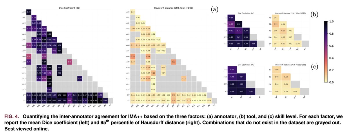 Hamarneh_MIA's tweet photo. New paper in IEEE Data Descriptions: 
IMA++: ISIC Archive Multi-Annotator Dermoscopic Skin Lesion Segmentation Dataset
💻Code: https://t.co/LNhQlhCDNm
📂Data: https://t.co/ytSfNZdtok
📰PDF:  https://t.co/p19kZJNgHQ https://t.co/aEjYBp6dH4
