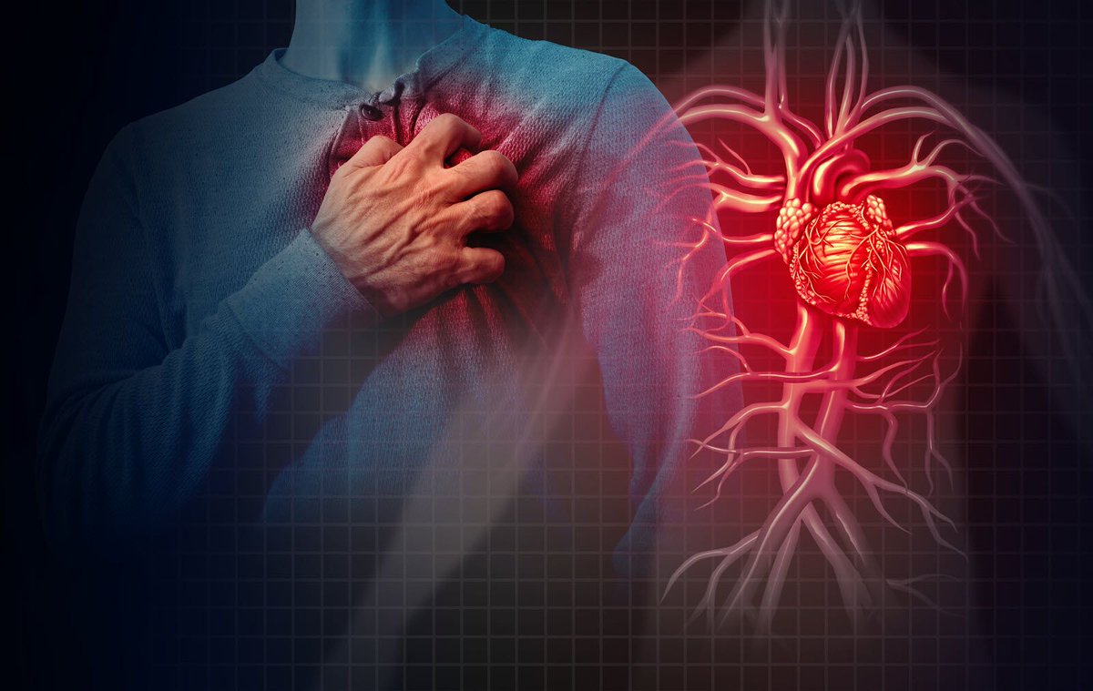 ECGTeacher's tweet image. Myocardial Infarction and Ischemia: ECG changes
buff.ly/6OrMyex
#emergencymedicine #intensivecare #respiratory #respiratorycare #icu #nurses #icunurse #ecg #ekg #cme #cmeonline
