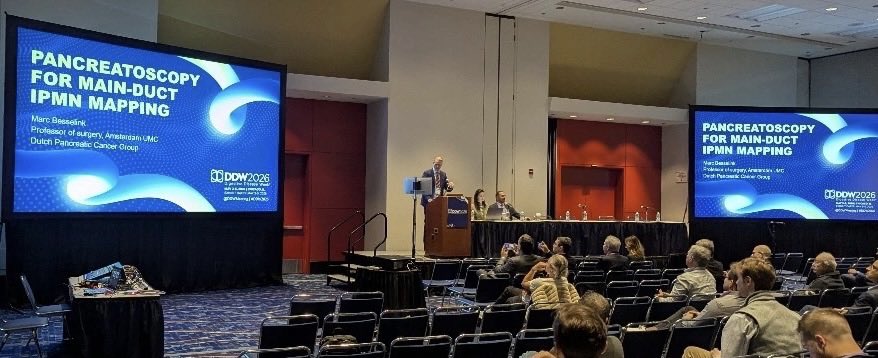 MarcBesselink's tweet photo. Excellent discussions on #Intraoperative #Pancreatoscopy for IPMN during @DDWMeeting 2026 #Chicago🇺🇸
🔥Take home message: the dilated pancreatic duct in MD-IPMN is NOT all diseased duct!
🎯Intraoperative Pancreatoscopy may help in 3 ways: confirming contralateral dilated duct has no IPMN, identifying skip lesions, an directing the type of pancreatic resection
👷Needed: classification system incl “flat IPMN” and correlation endoscopy with pathology
✅Presenting our upcoming #PIRANA trial with @DPCG_official @Gio_Marchegiani @EAHPBA
Many thanks to Urban Arnelo for your pioneering work
#Pancreatic #Surgery #SEEGEN