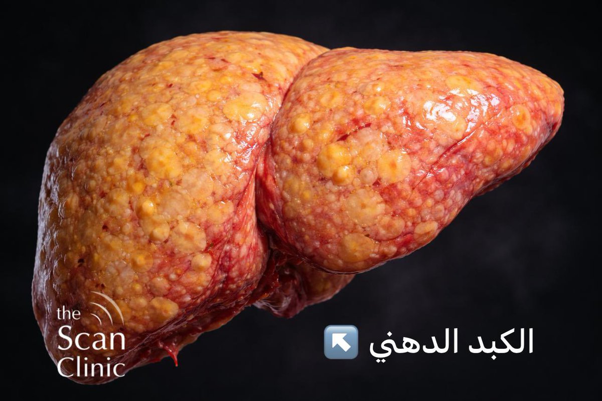 د. يوسف ال زاهب tweet media