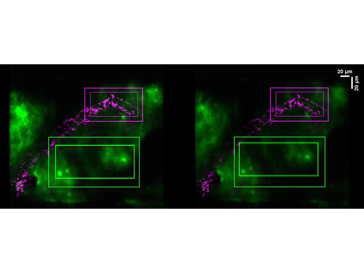 Hydraulic brain: Body motion linked to fluid movement in the brain and washing away cerebral waste regenhealthsolutions.info/2026/05/02/hyd…