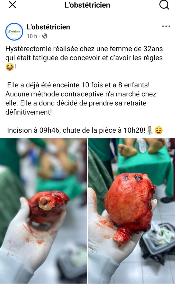Biakpa Aouti 🇨🇮 (Prophète Amos) tweet media
