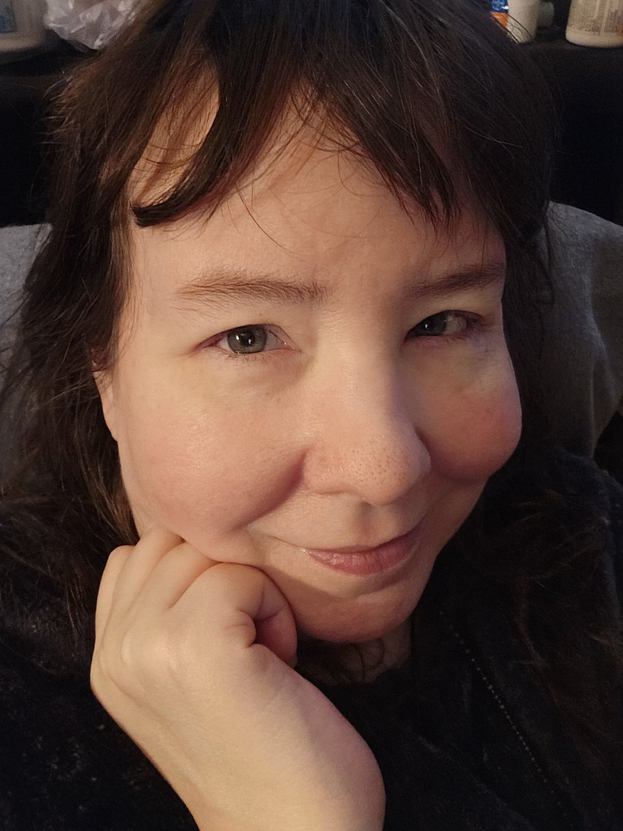 luvsbobcrane's tweet image. Look better still in pain. Still side pains confused if its kidney stones or if the bus ride was too bumpy and messed me up. #nofilterneeded