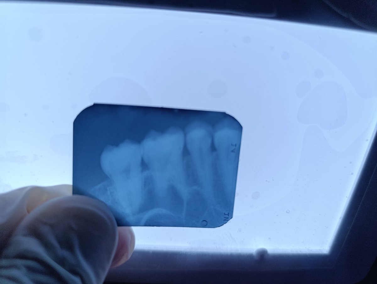 BiomagnetismoES's tweet photo. 🦷 https://t.co/0svlvo6q71