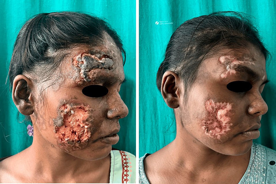 What is the diagnosis or Syndrome ⁉️