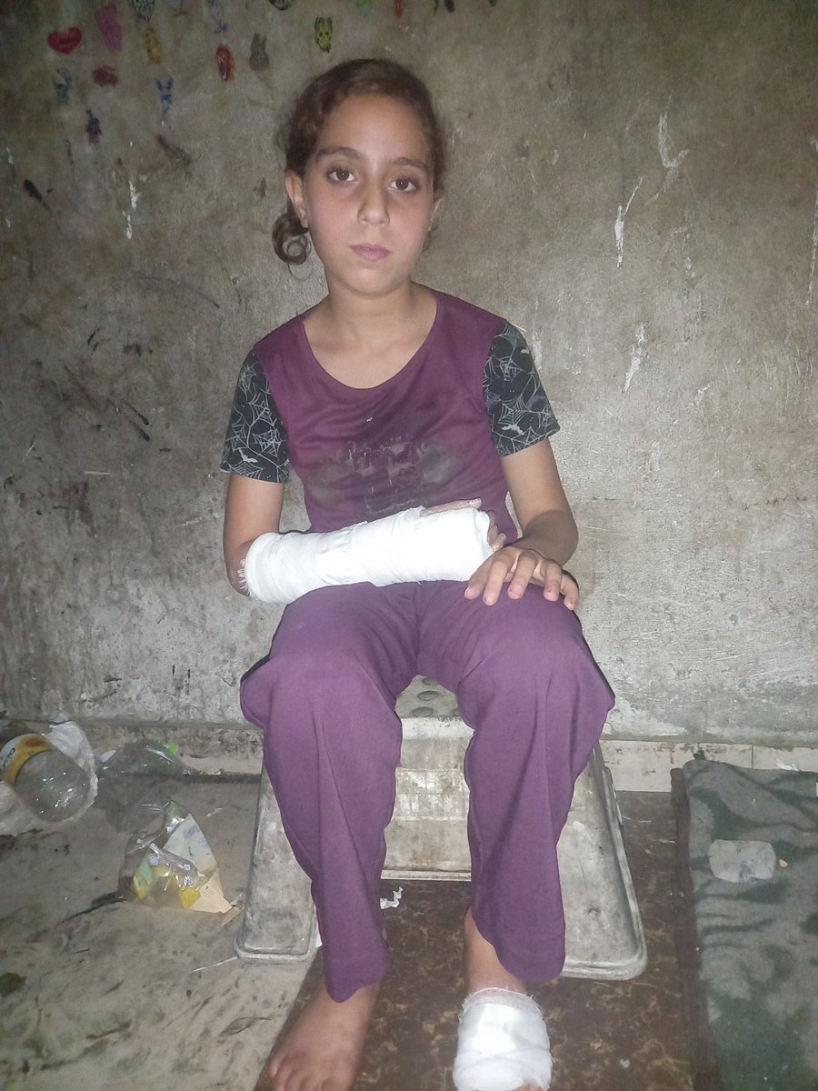 EAhmed53947's tweet image. Urgent appeal. 
Please Today my daughter Mays was waiting in line for water,and it was very crowded.Because of the crowd, she fell to the ground and broke her arm.She is now in pain and suffering She needs medication,a healthy diet to strengthen her bones. chuffed.org/project/ezdhar…