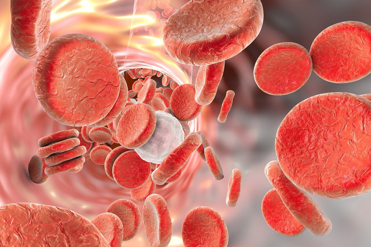 AcadoodleMed's tweet image. How to Read a Venous Blood Gas (VBG) - Top 5 Tips
buff.ly/QyTsklO
#emergencymedicine #intensivecare #respiratory #respiratorycare #icu #nurses #icunurse #ecg #ekg #cme #cmeonline