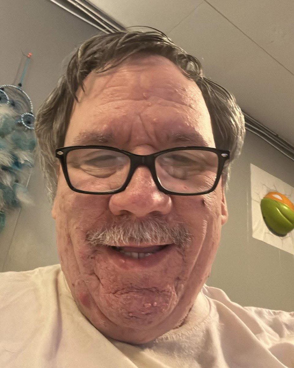 Watson tweet media