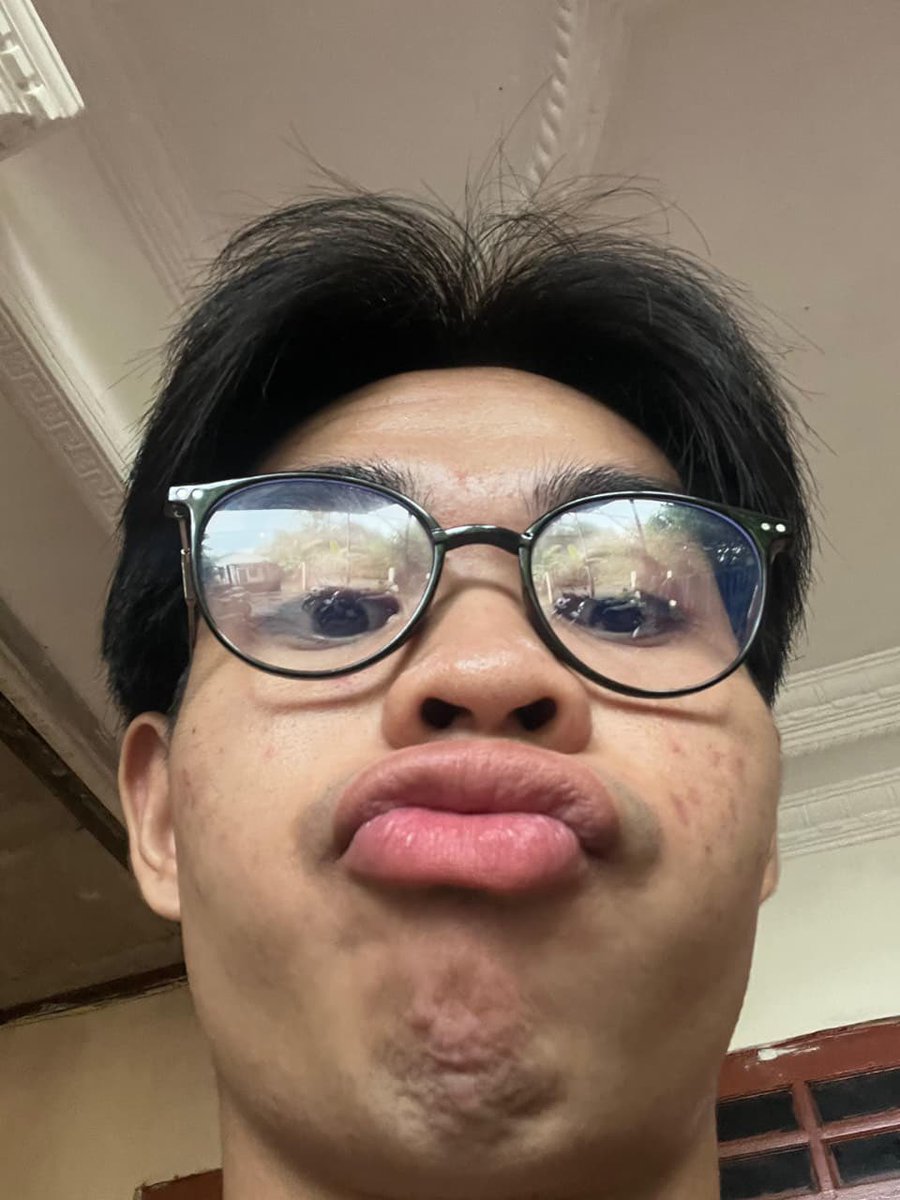 Flattened Man Guy Duckface Gooner tweet media