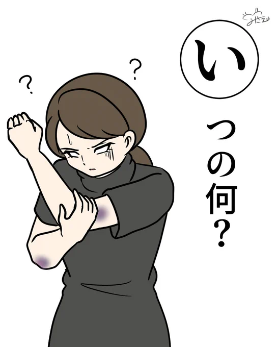 #白目カルタ

「いつの何?」

なんか気付いたらどこか痛い

青たん(関西)できてたり
切り傷があったり
少し皮むけてたり

これ、いつ何したやつ? 