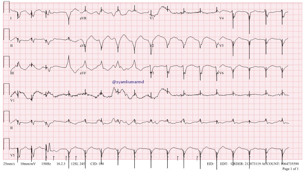 syamkumarmd's tweet image. Diagnosis? #Epeeps