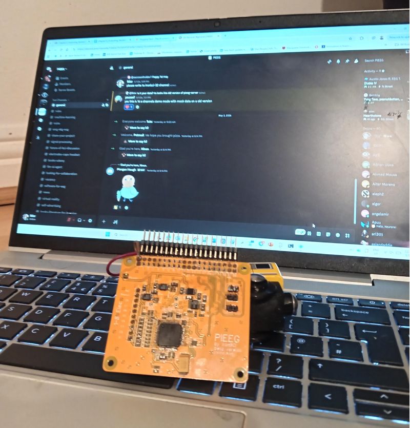 pieeg_official's tweet photo. Happy to share that one of the most active Neuroscience and EEG communities for EEG research just hit 800 members!!! 🚀

Let's keep building the future of neurotech together! 🧠✨
Join us here in Discord: https://t.co/ANR86b58vS

#EEG #Neurotechnology #Biosignals #BrainWaves https://t.co/x2FjEqg0Ff
