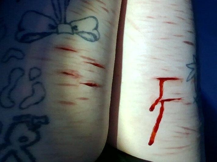necrokitty420's tweet photo. fake blood fake cuts #slitwt #cutspo #beanspo #styrospo #styrotwt #shedtwt #shtwt #fakebody #seshy #drugtwt #bpdtwt #multiswipe https://t.co/xJHqkol55T