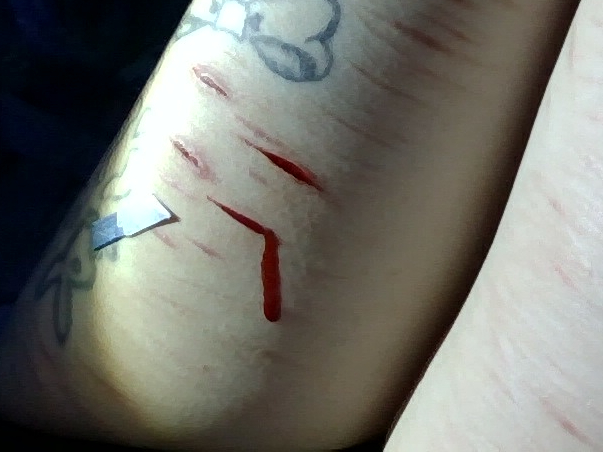 necrokitty420's tweet photo. fake blood fake cuts #slitwt #cutspo #beanspo #styrospo #styrotwt #shedtwt #shtwt #fakebody #seshy #drugtwt #bpdtwt #multiswipe https://t.co/xJHqkol55T