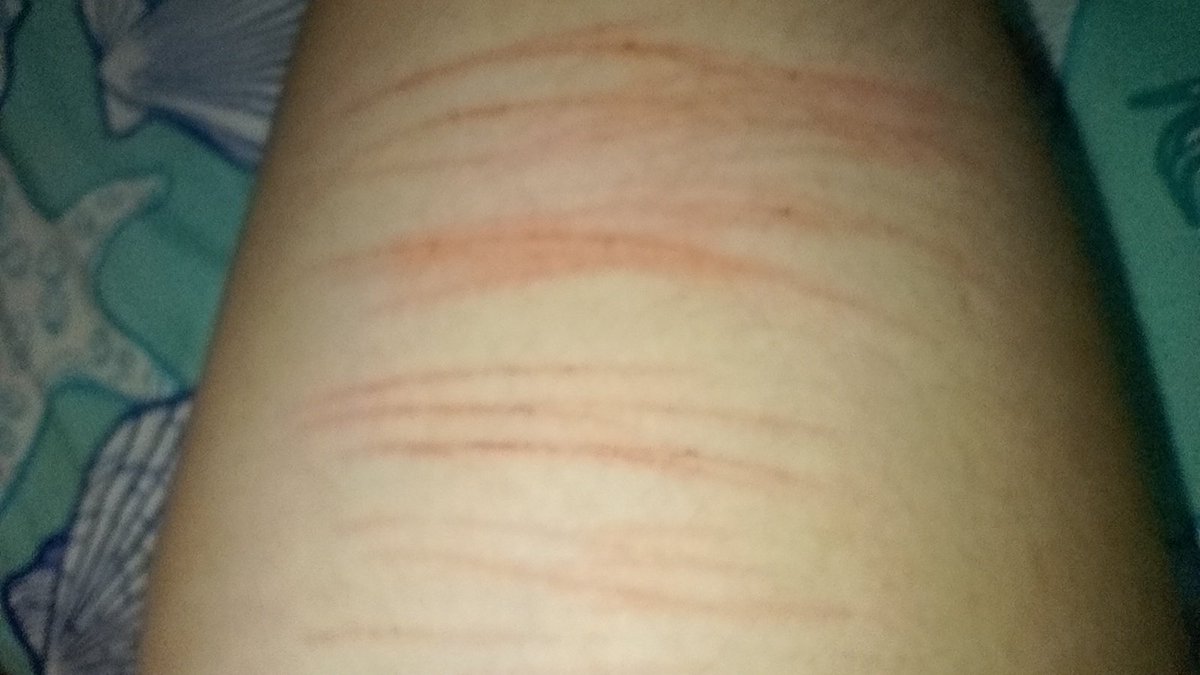 Ashley_cutegore's tweet image. Tbh i feel kinda Bad, It makes me feel so guilty when my mom tells me off for cutting myself and says it makes her sad that I do that, but at the same time I can't stop, I don't want to stop cutting myself #vent #SH #selfharm #SelfHarm #SHtwt #shtwt #fypシ゚viralシfypシ゚