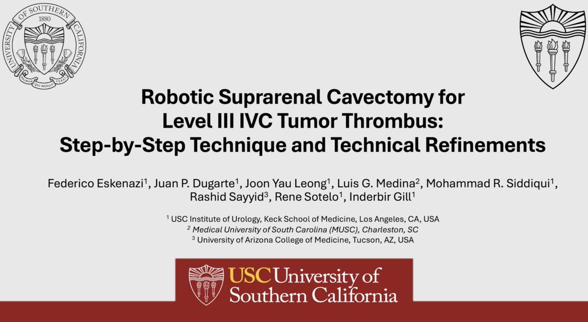 jpdugartemd's tweet photo. Proud to share that our team had 3 studies accepted at SRS 2026 🤖

Topics include zero-ischemia partial nephrectomy, robotic fascial puboprostatic sling, and robotic suprarenal cavectomy for level III IVC tumor thrombus.

Grateful to our mentors and collaborators.

#Urology #SRS https://t.co/54J8L6dAcL