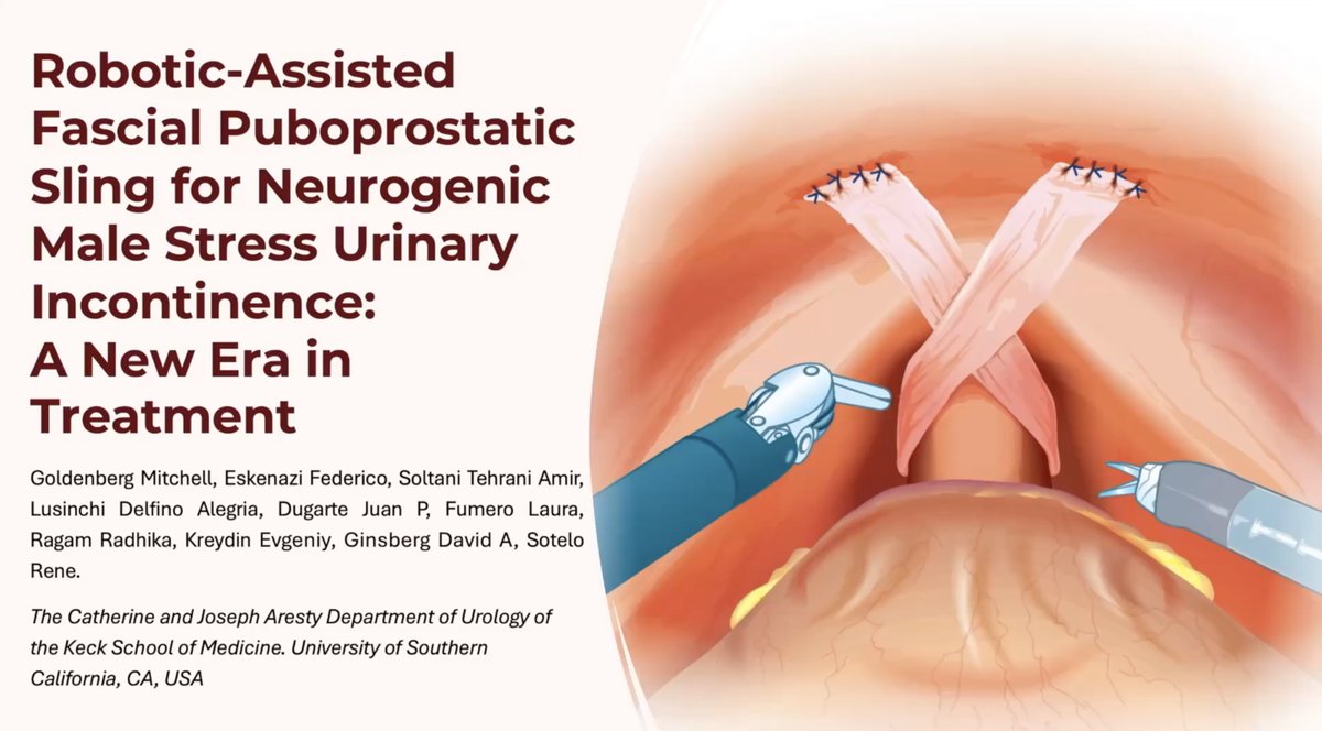 jpdugartemd's tweet photo. Proud to share that our team had 3 studies accepted at SRS 2026 🤖

Topics include zero-ischemia partial nephrectomy, robotic fascial puboprostatic sling, and robotic suprarenal cavectomy for level III IVC tumor thrombus.

Grateful to our mentors and collaborators.

#Urology #SRS https://t.co/54J8L6dAcL