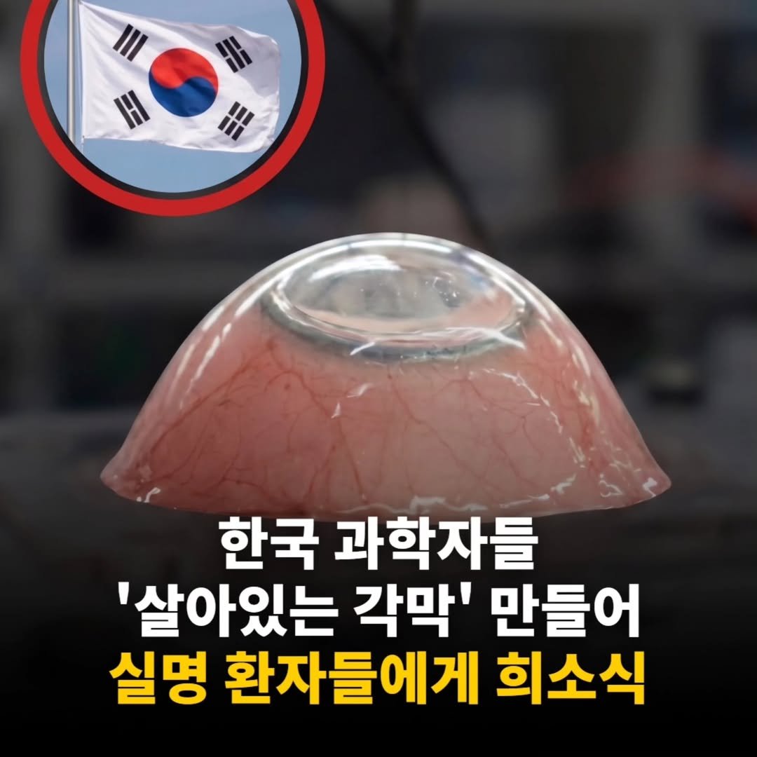 <실명환자들의 희소식! 오래 살고 봐야하네요.>

포항공대와 경북대 연구팀이 3D 바이오프린팅으로 
인공 각막 제작에 성공했습니다. 

탈세포화 각막 기질과 줄기세포 기반 바이오잉크로 
콜라겐 구조를 실제처럼 구현했고, 
전단 응력 제어로 섬유 정렬까지 완성했습니다. 

투명도와 유연성도