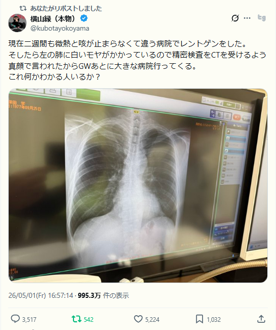 asinukimss's tweet image. 🟩横山緑、レントゲン画像でバズる🩻
➡View＞1千万に迫る。リプ数＞3,500越え

・イイネは引用リプを付けた浜田聡氏とほぼ同じ＞5,000 
（識者によるとレントゲンだけの現時点では一切何も断定できないらしい）
#KICK #バズ #バズった #Buzz #配信者健康