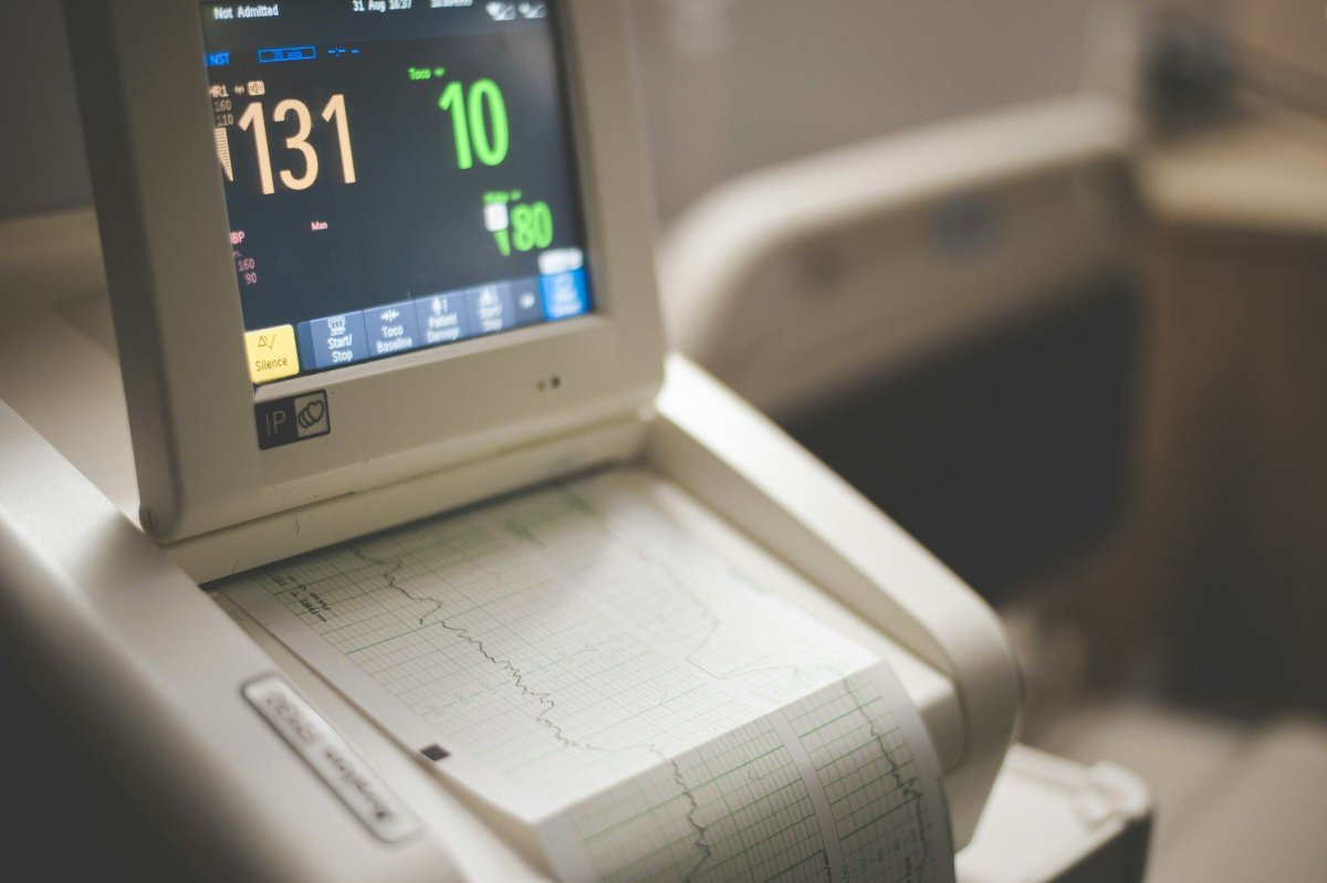 lifecourseUofT's tweet image. Individuals with worse #cardiac structure at higher risk of developing adverse #health outcomes and #mortality long-term eurekalert.org/news-releases/…