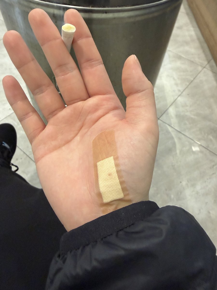 bo_170's tweet photo. 쿠우쿠우에서 일하면서 1일1상처 달성중임 무릎도 까지고 발목도….. https://t.co/HmqDeD2QyB