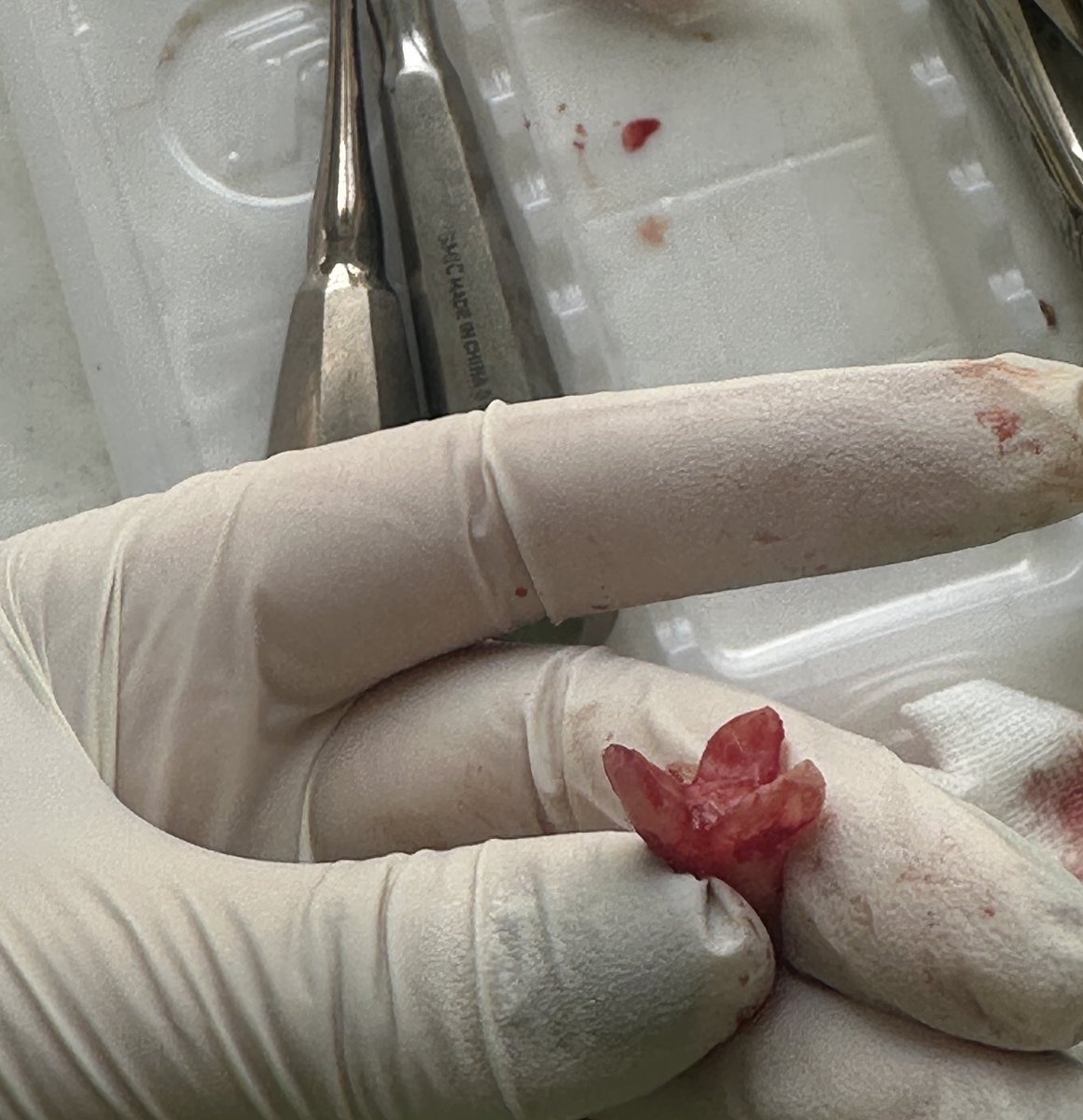 چِری بِری tweet media