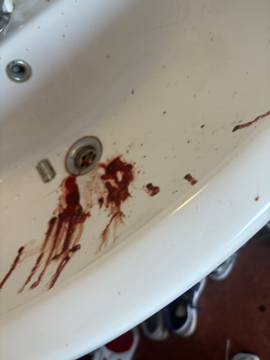 2mina2cute's tweet image. #shedtwt 
#sh 
#blood 
#mess