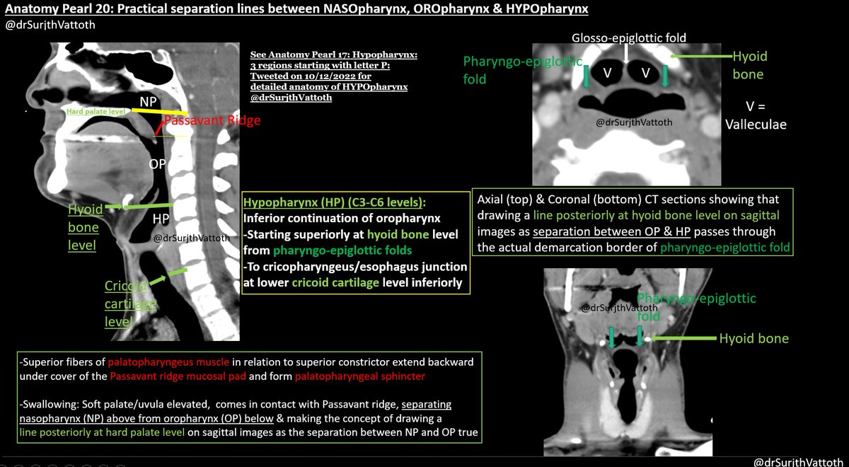 drSurjthVattoth's tweet photo. Anatomy Pearl 20: Practical separation lines between NASOpharynx, OROpharynx &amp; HYPOpharynx https://t.co/DEXxylk1cS