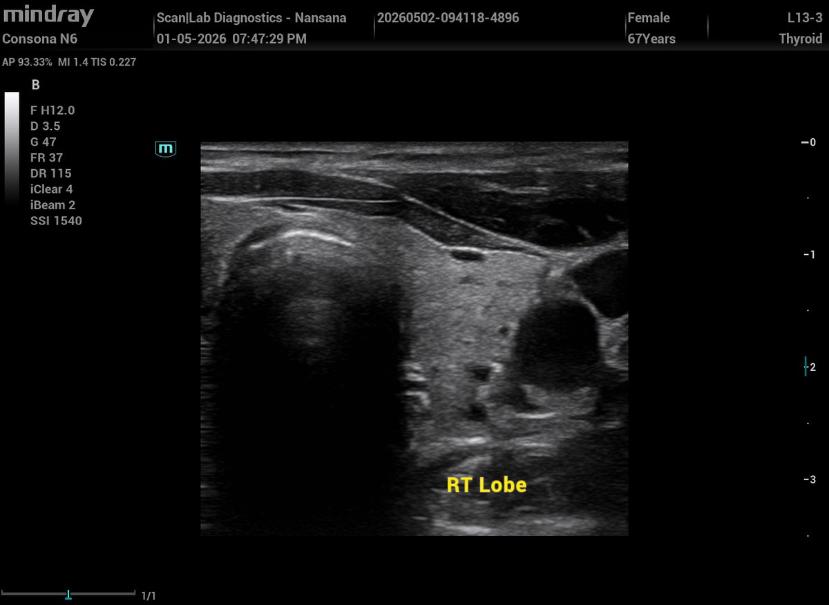Ambrose - The Sonographer (Sonar Master). tweet media