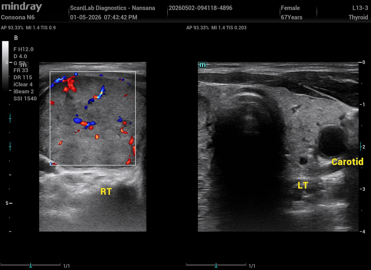Ambrose - The Sonographer (Sonar Master). tweet media