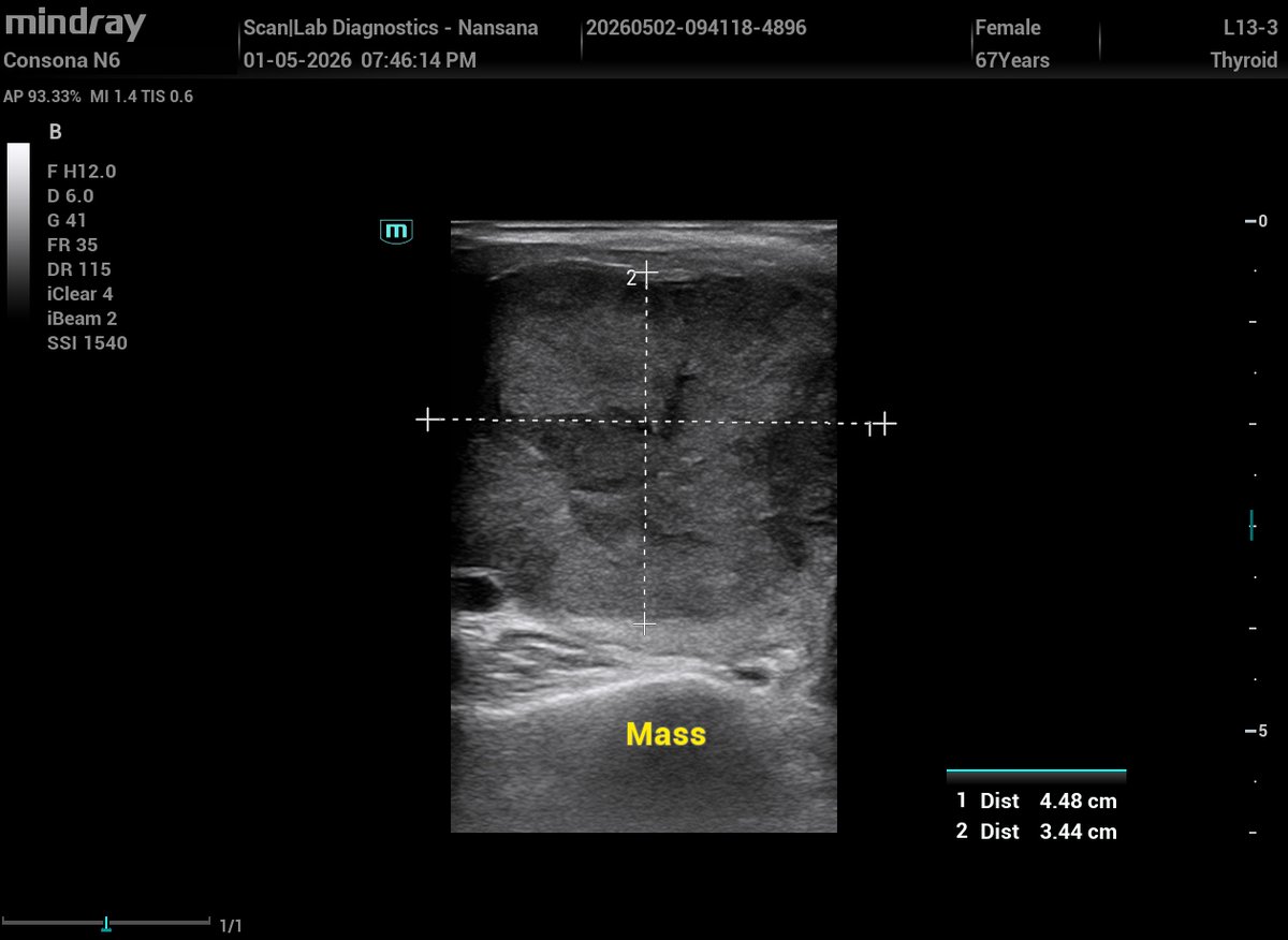 Ambrose - The Sonographer (Sonar Master). tweet media