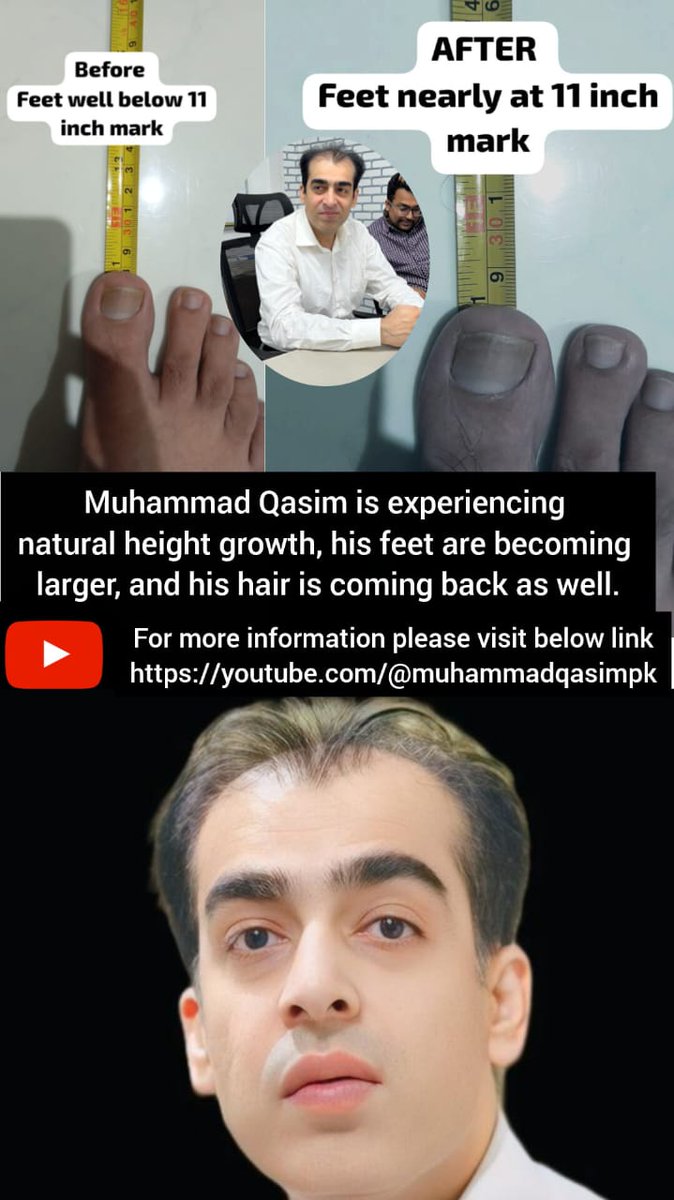 Aya tweet media