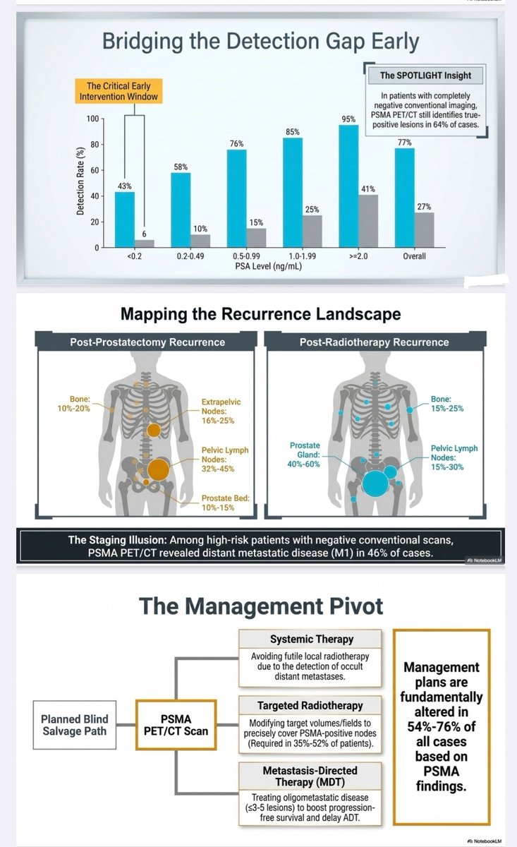 roxboxfix's tweet photo. PSMA PET/CT imaging for biochemical recurrence in prostate cancer: 
Can it replace conventional imaging and guide salvage therapy?

Annals of Nuclear Medicine (2026) 40:469–479
https://t.co/6df5gLVt1V https://t.co/ULDaWiTVS6