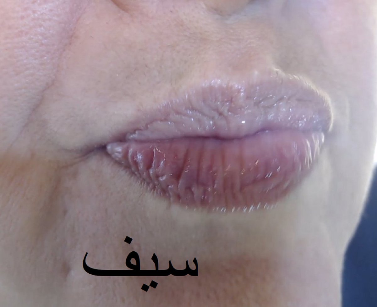 سيف الباسم tweet media