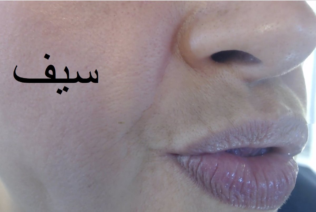 سيف الباسم tweet media