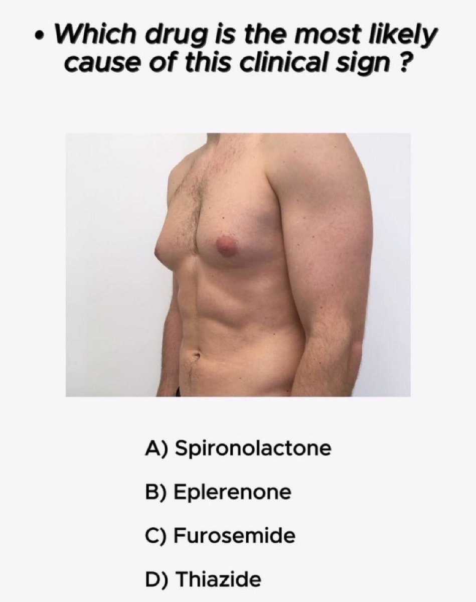 Which drug is the most likely cause of this clinical sign ?✍️