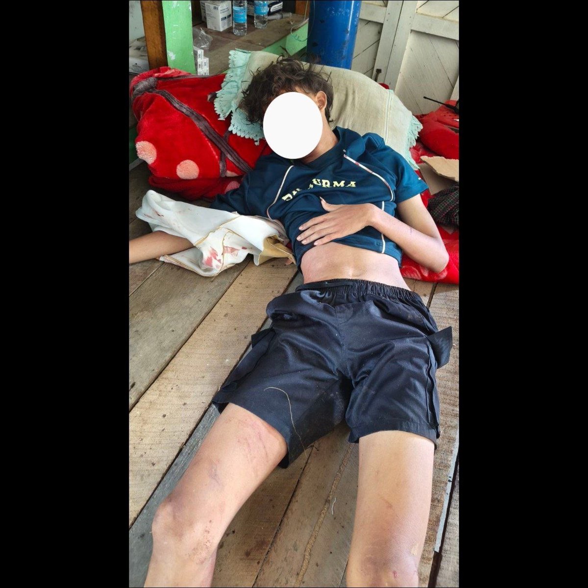 SithuAung285162's tweet image. On May 2, in Hpakant Township, insurgent KIA/PDF groups carried out another bomb attack targeting a civilian vehicle, injuring two men and one woman.
The #KIA, which has become a serious concern for the public, should be dealt with firmly.
#WhatsHappeninginMyanmar
#KIA #PDF