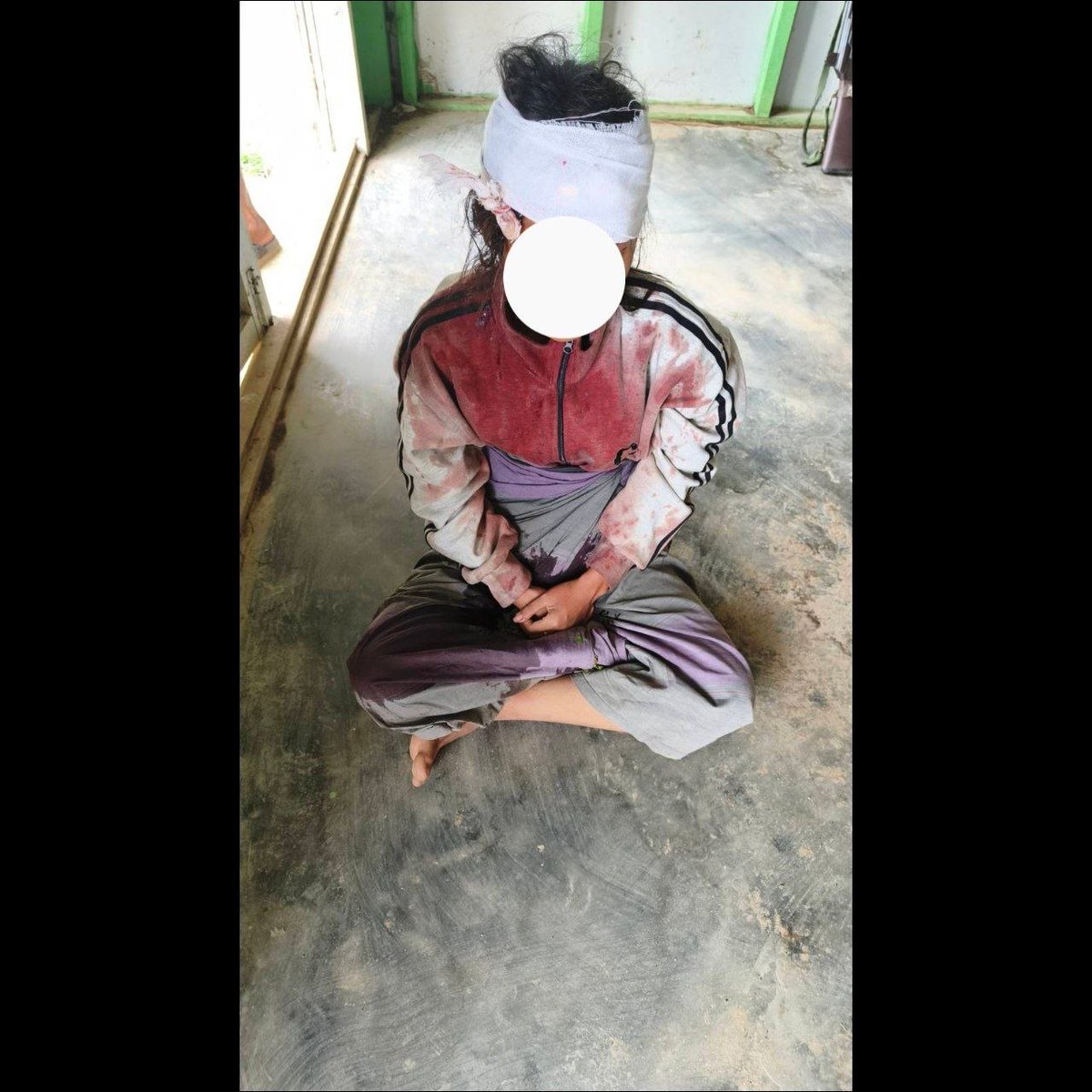 SithuAung285162's tweet image. On May 2, in Hpakant Township, insurgent KIA/PDF groups carried out another bomb attack targeting a civilian vehicle, injuring two men and one woman.
The #KIA, which has become a serious concern for the public, should be dealt with firmly.
#WhatsHappeninginMyanmar
#KIA #PDF