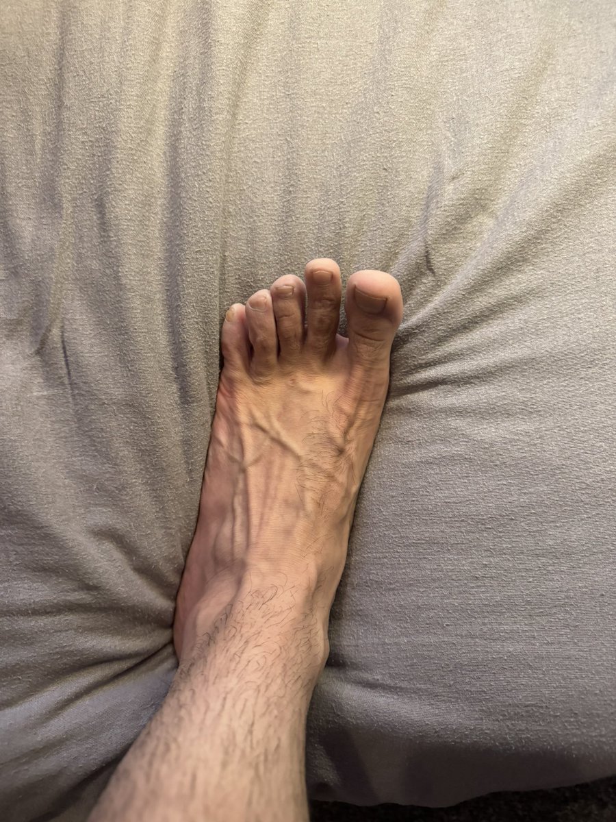 Alex_Londonboyy's tweet photo. like the veins? https://t.co/vnMzA8qu4R