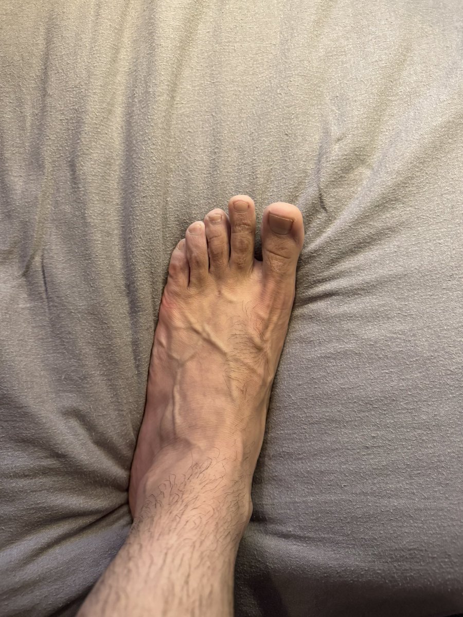 Alex_Londonboyy's tweet photo. like the veins? https://t.co/vnMzA8qu4R