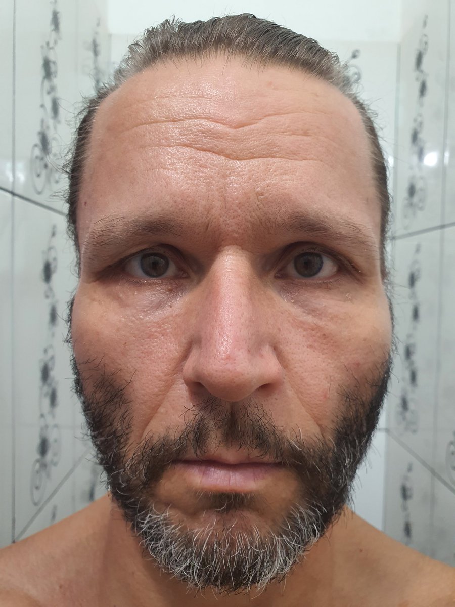 SalomonRejuven's tweet image. 💥 I found the fountain of youth of the emperors.
Day 4522. Age 53 → reversing into low 40s.
No filters. No shortcuts. Just biology reactivated.
Goal: 25.
I post daily until I get there. Watch closely.
💪
#RejuvenationBodybuilding #ReverseAging #Longevity #Shredded