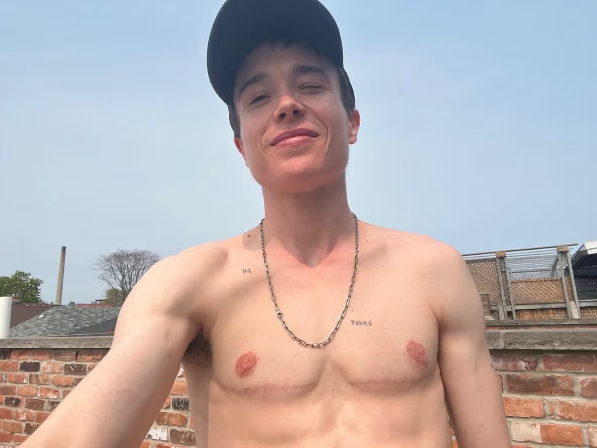 Patrick Ojota tweet media