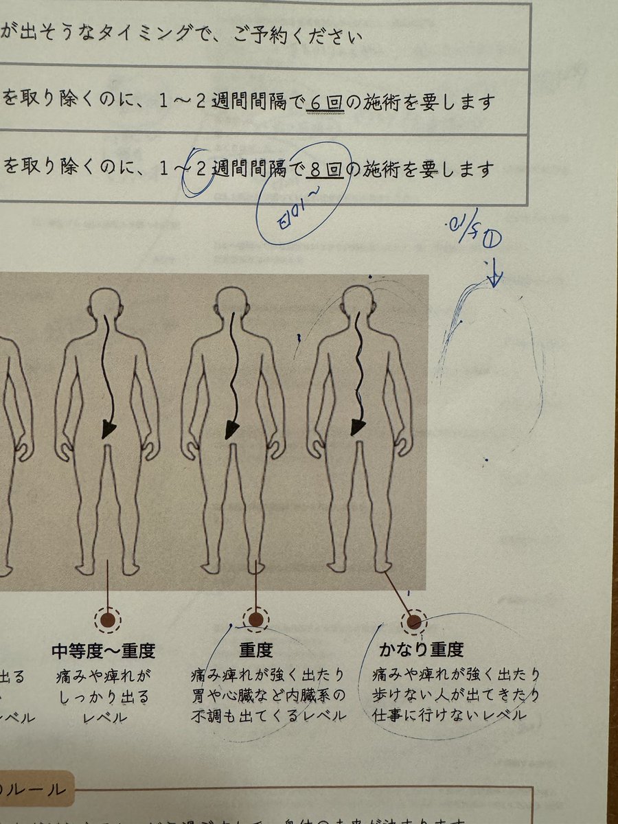 aisaikayuto's tweet photo. 女性初、枠外の歪みの方が来られた…30年ほど九州のあらゆる施術は全て試したという方。この痛みが薬もどこに行っても取れない、と。5回の仙骨調整で歪みはかなり取れたが、体感でしっかりわかるのは8回は必要になると思う。この方の8回後が楽しみでならない。 https://t.co/6DMGz7TM2H